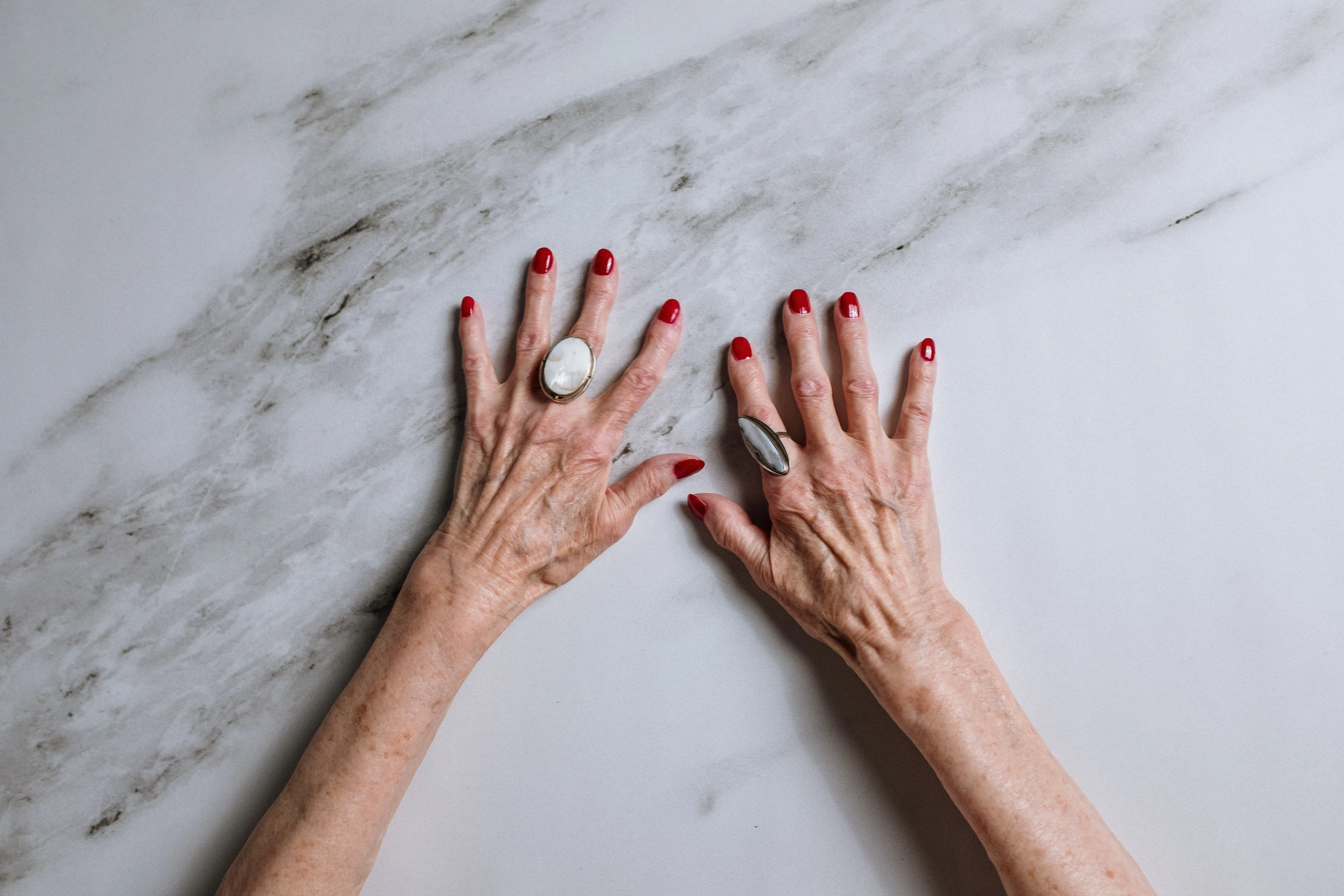 taches brunes sur les mains