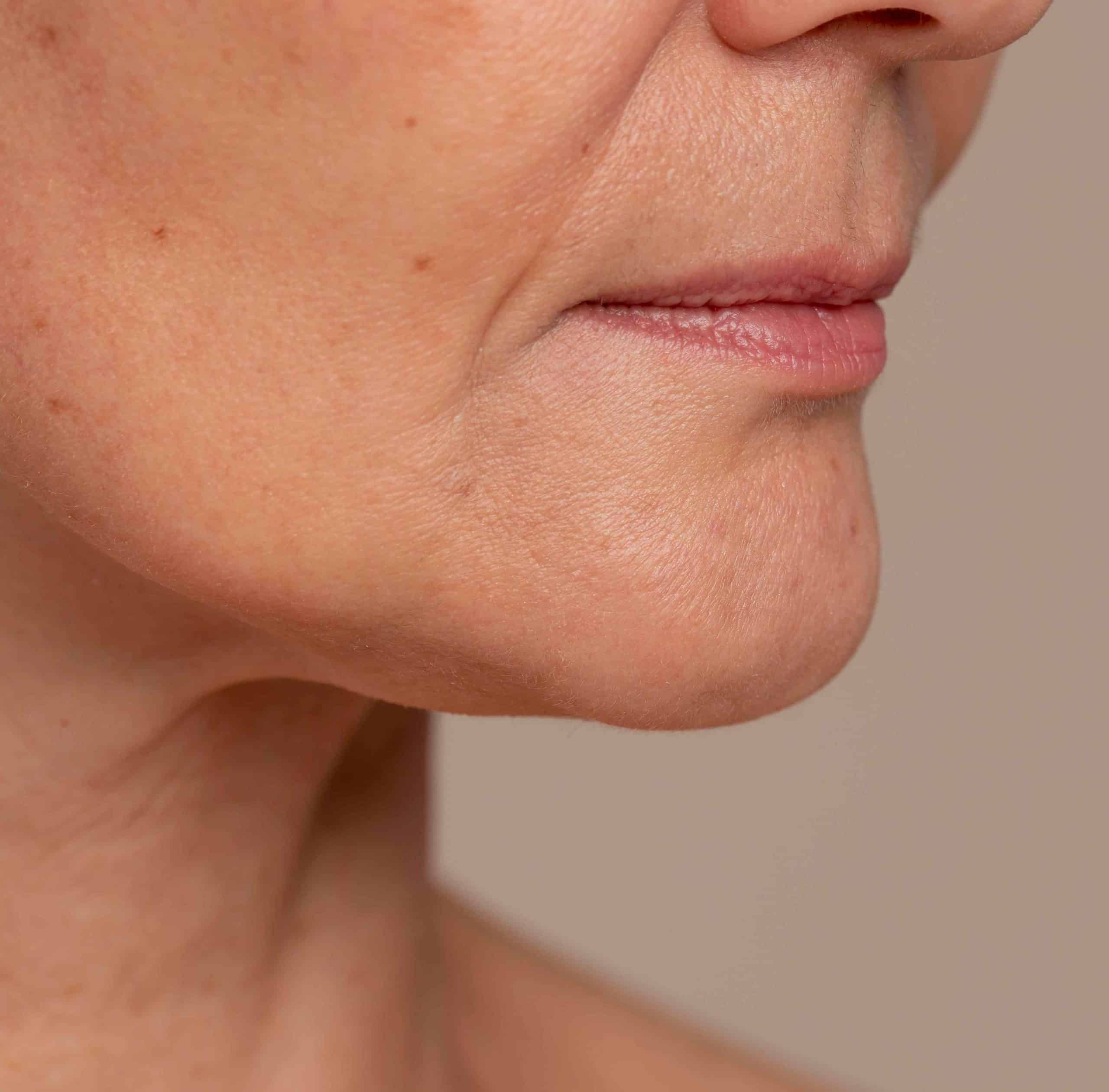 Pourquoi le double menton apparaît : les 4 vraies causes